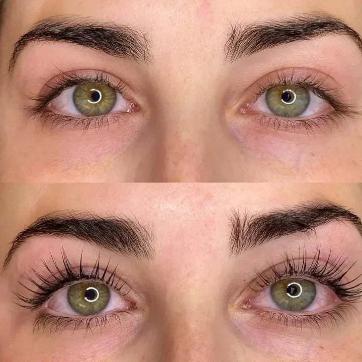 SERUM X10 🚀 CRECIMIENTO ACELERADO + 3 PARCHES DE COLAGENO 🎁 || BIOAQUA