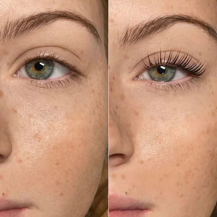 SERUM X10 🚀 CRECIMIENTO ACELERADO + 3 PARCHES DE COLAGENO 🎁 || BIOAQUA